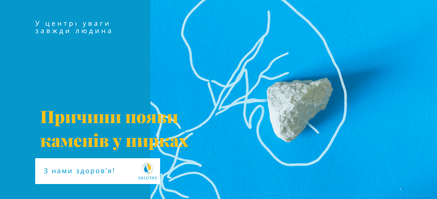 Як видалити камені в нирках