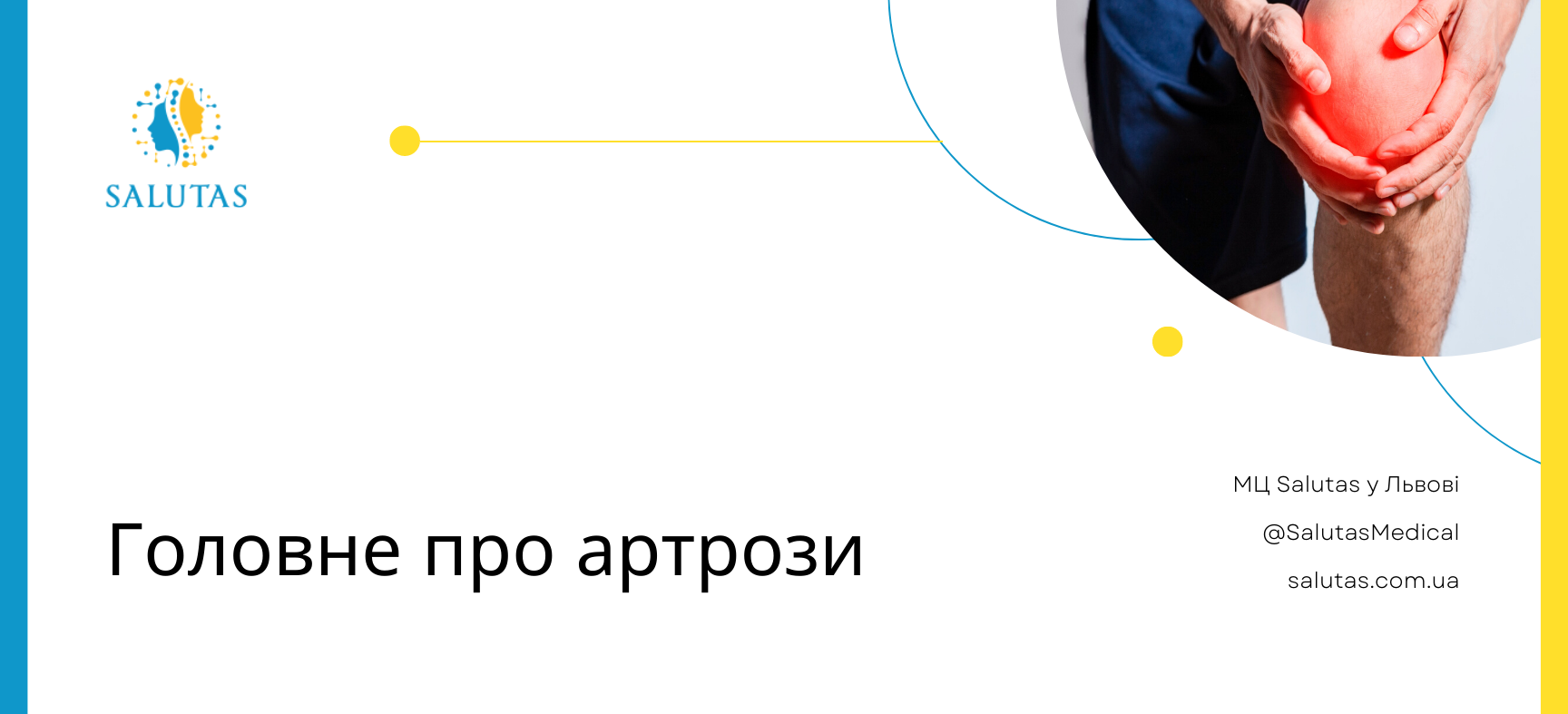 Головне про артрози