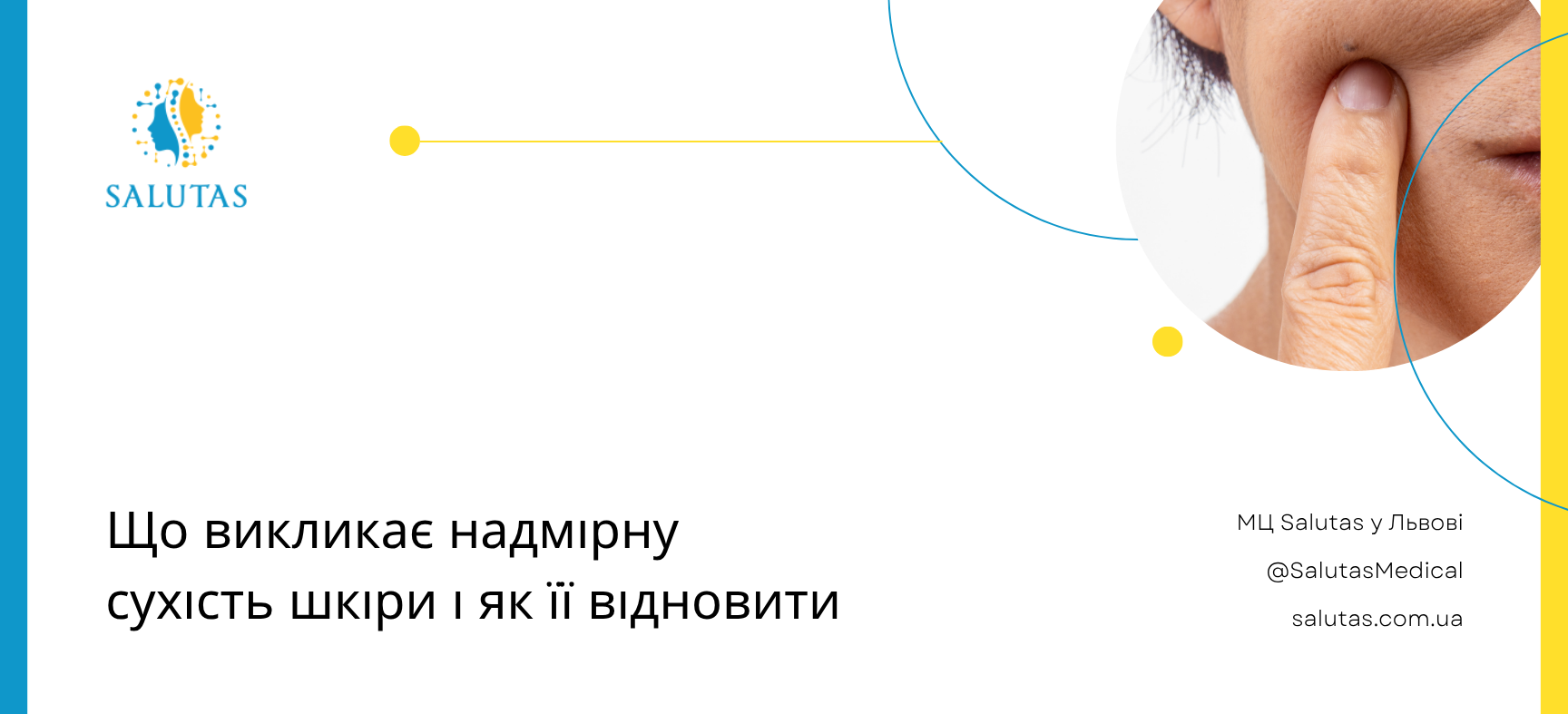 Сухість шкіри