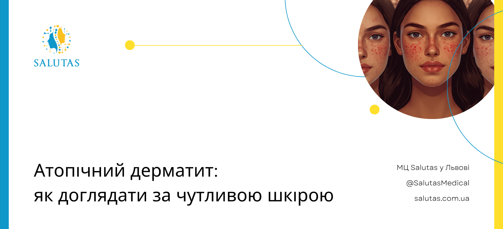 Атопічний дерматит: як доглядати за чутливою шкірою