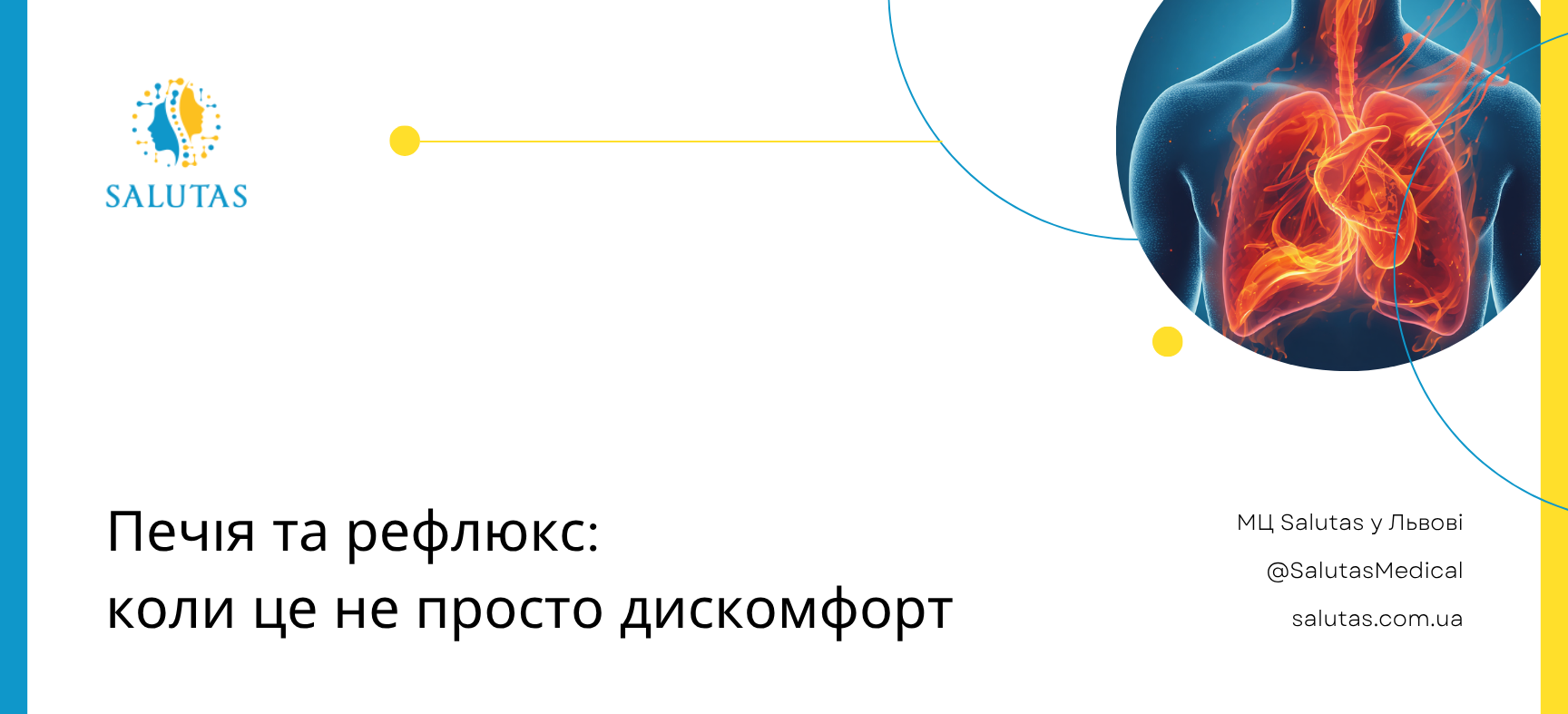 Печія та рефлюкс: коли це не просто дискомфорт