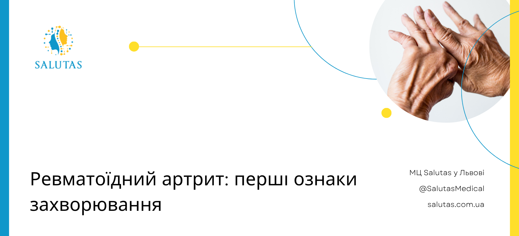 Перші ознаки ревматоїдного артриту